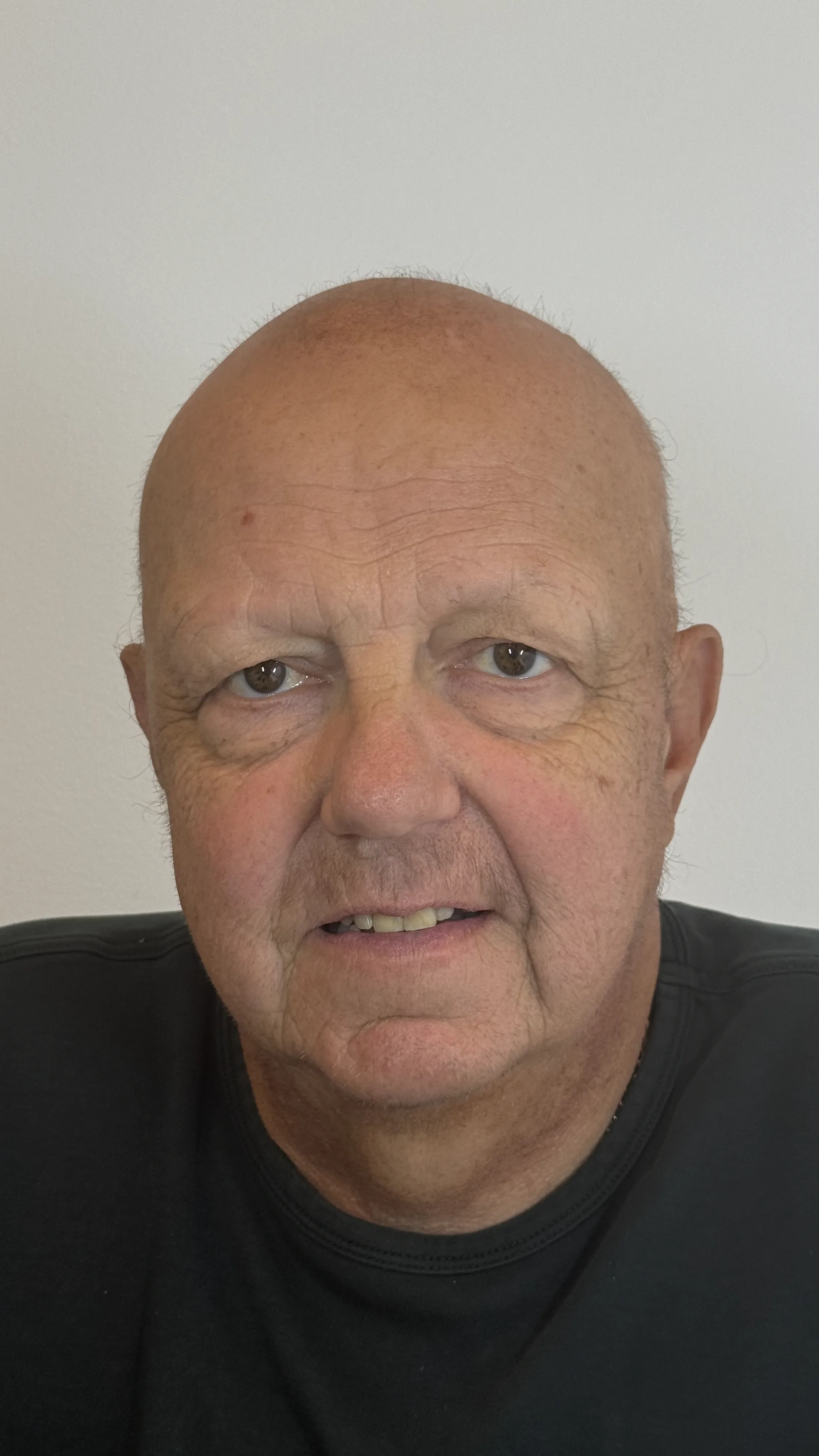 Herrebryn før PMU-behandling